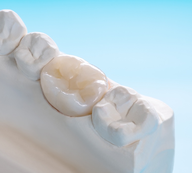 Model smile with dental crown restoration