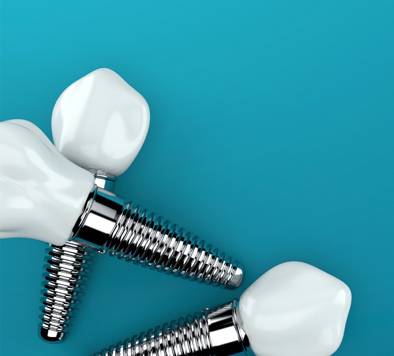 Three animated dental implant supported dental crowns