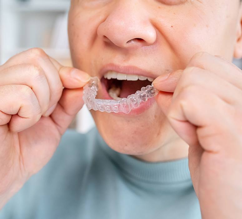 a patient removing their Invisalign aligner