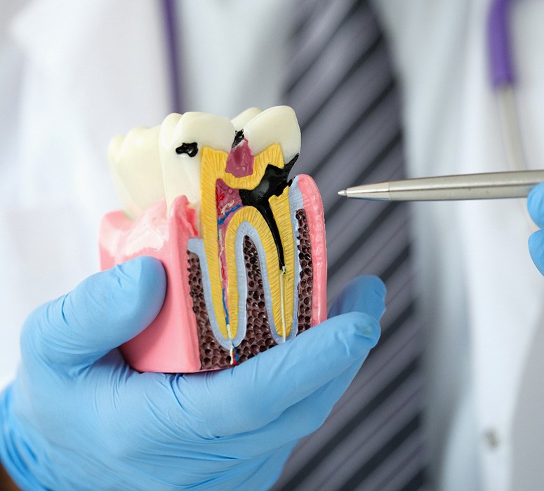 Woman in dental chair undergoing root canal