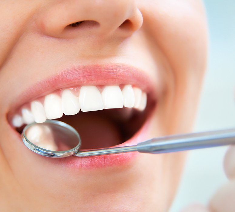 Dentist checking patient's smile after tooth colored filling restoration