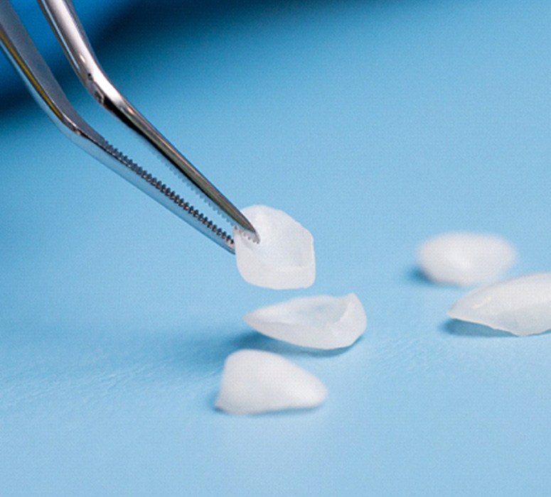 A tweezer holding veneers