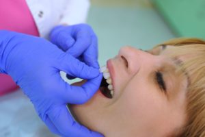Woman with blond hair having a veneer placed by a dentist wearing blue gloves