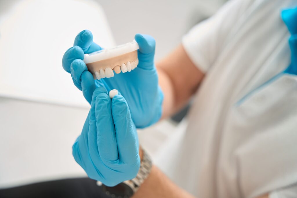 Blue-gloved hands placing sample crown over model tooth